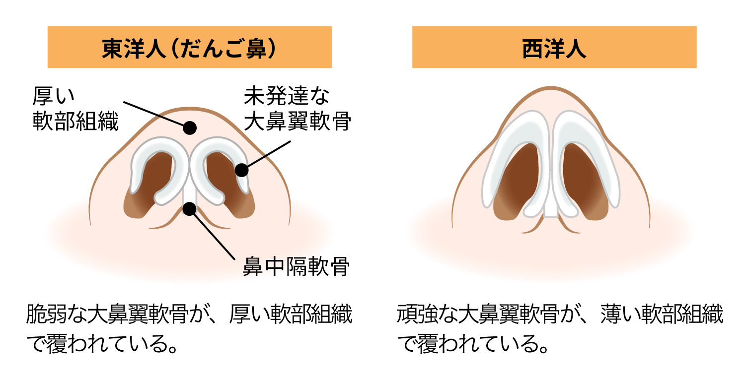 鼻の部位②鼻尖～気になる部位の見方と適切な治療法(特に団子鼻について)