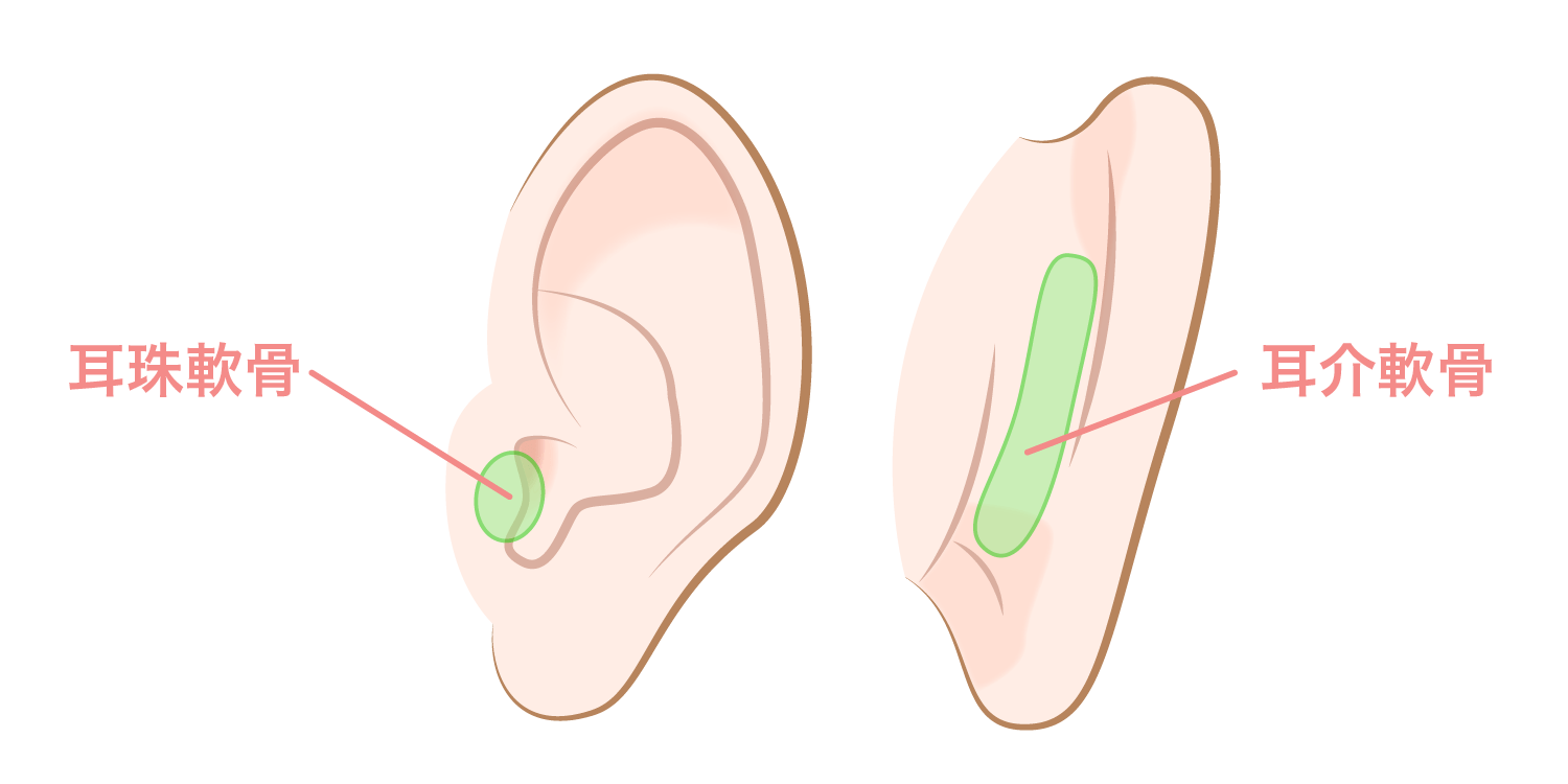 　　　　　　　　 軟骨採取部位 ：耳介軟骨 、耳珠軟骨