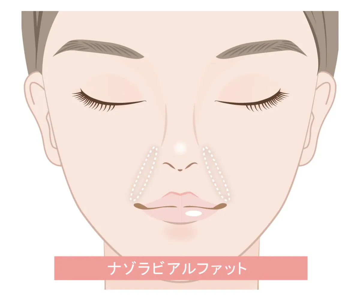 ナゾラビアルファットって何？
