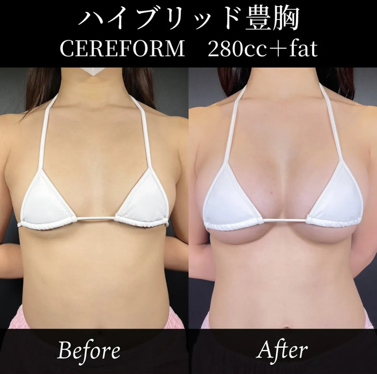 バストに自然な谷間を作るには？
