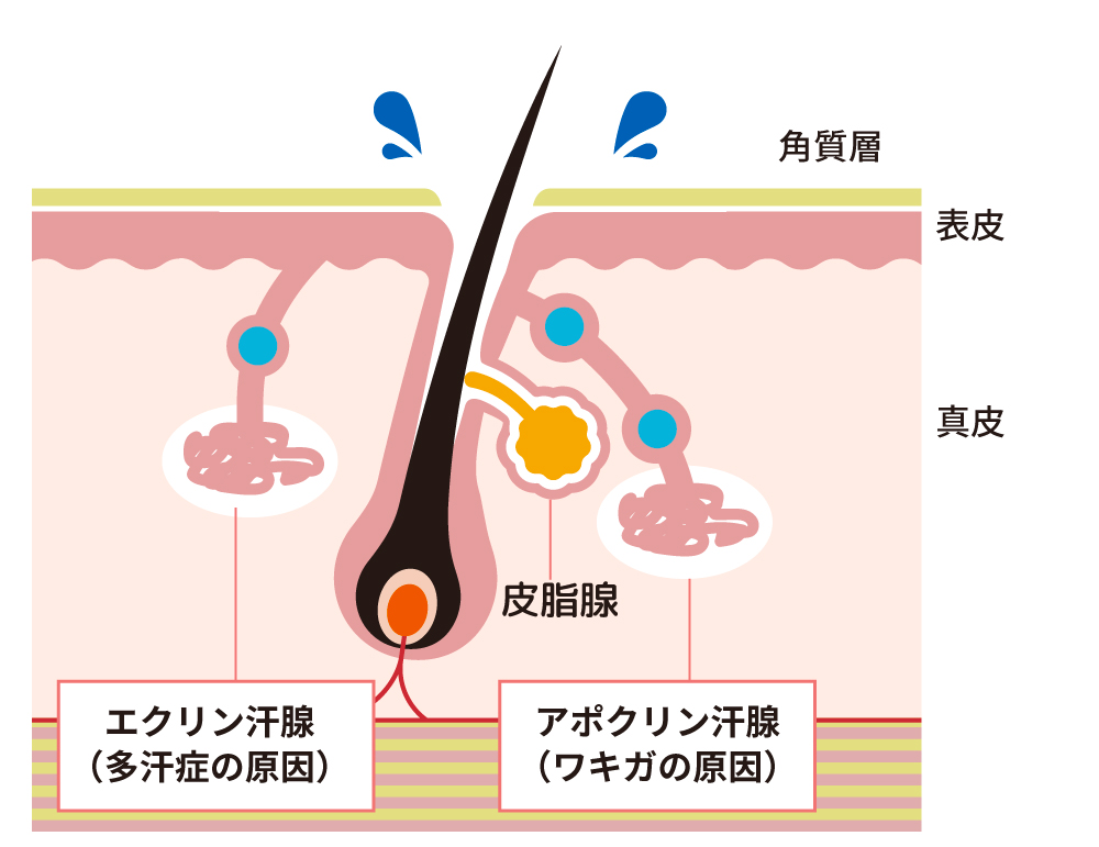 知っていますか？気になるワキ汗・汗ジミ