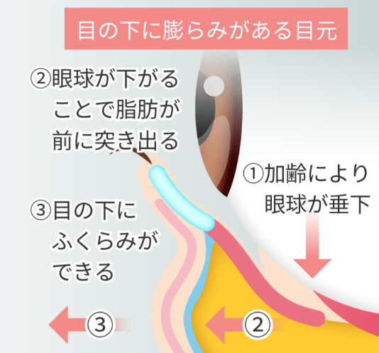 クマ治療の手術中の痛み！！実際どうなの？