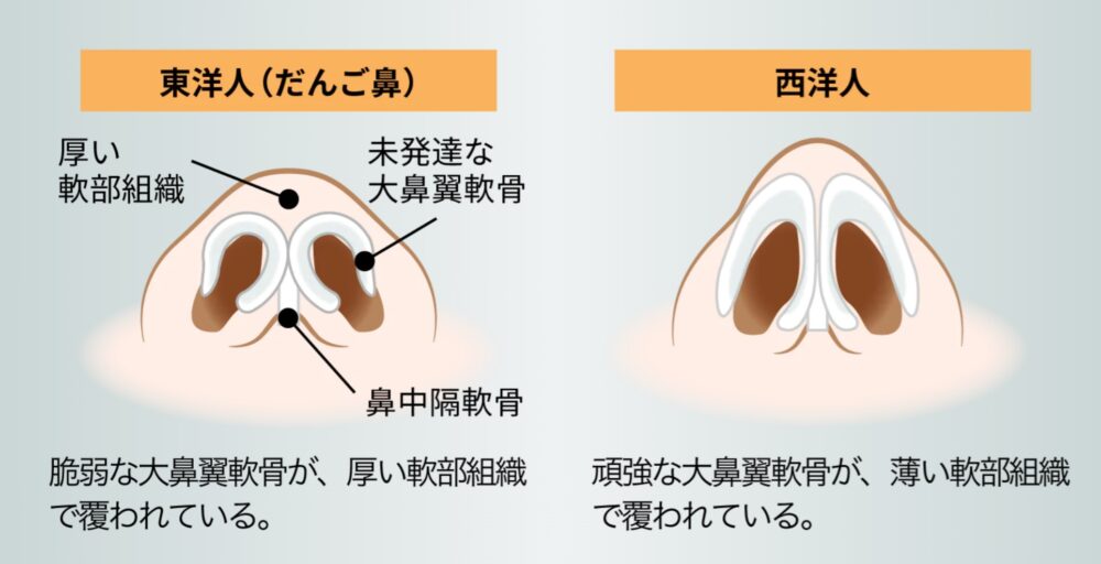 鼻の穴の形を変える！②～下から見た時の丸さを変える