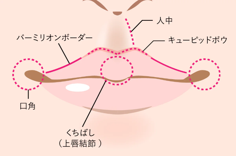 唇ヒアルロン酸で可愛いリップを作る方法