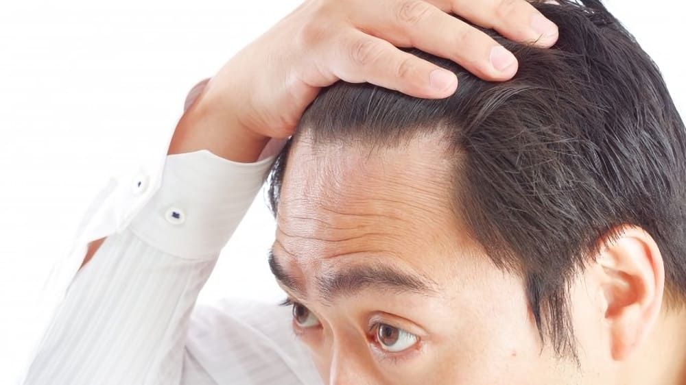 おでこのシワをなくす男性向けの方法10選！額のシワの原因や改善法、ヒアルロン酸などのメンズ整形を解説