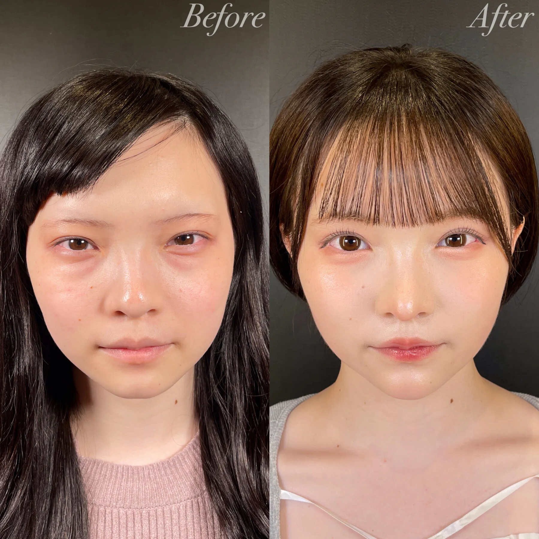 整膚美容大全(定価35000円) 全顔フル整形 | アールビューティークリニック 銀座・名古屋