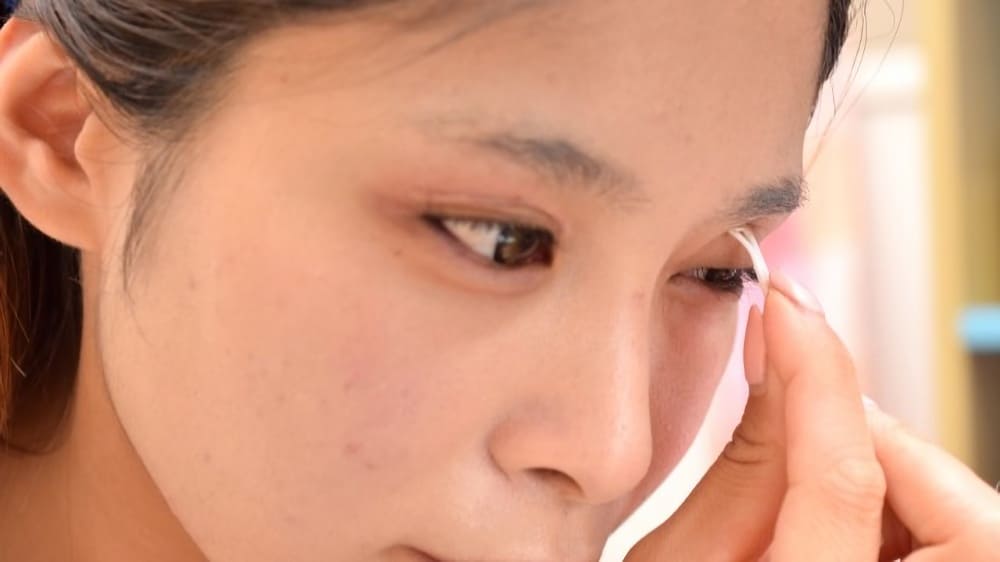 アイプチはやりすぎるとどんな危険性がある？6つのまぶた・皮膚の症状や対処法、おすすめ二重整形を解説