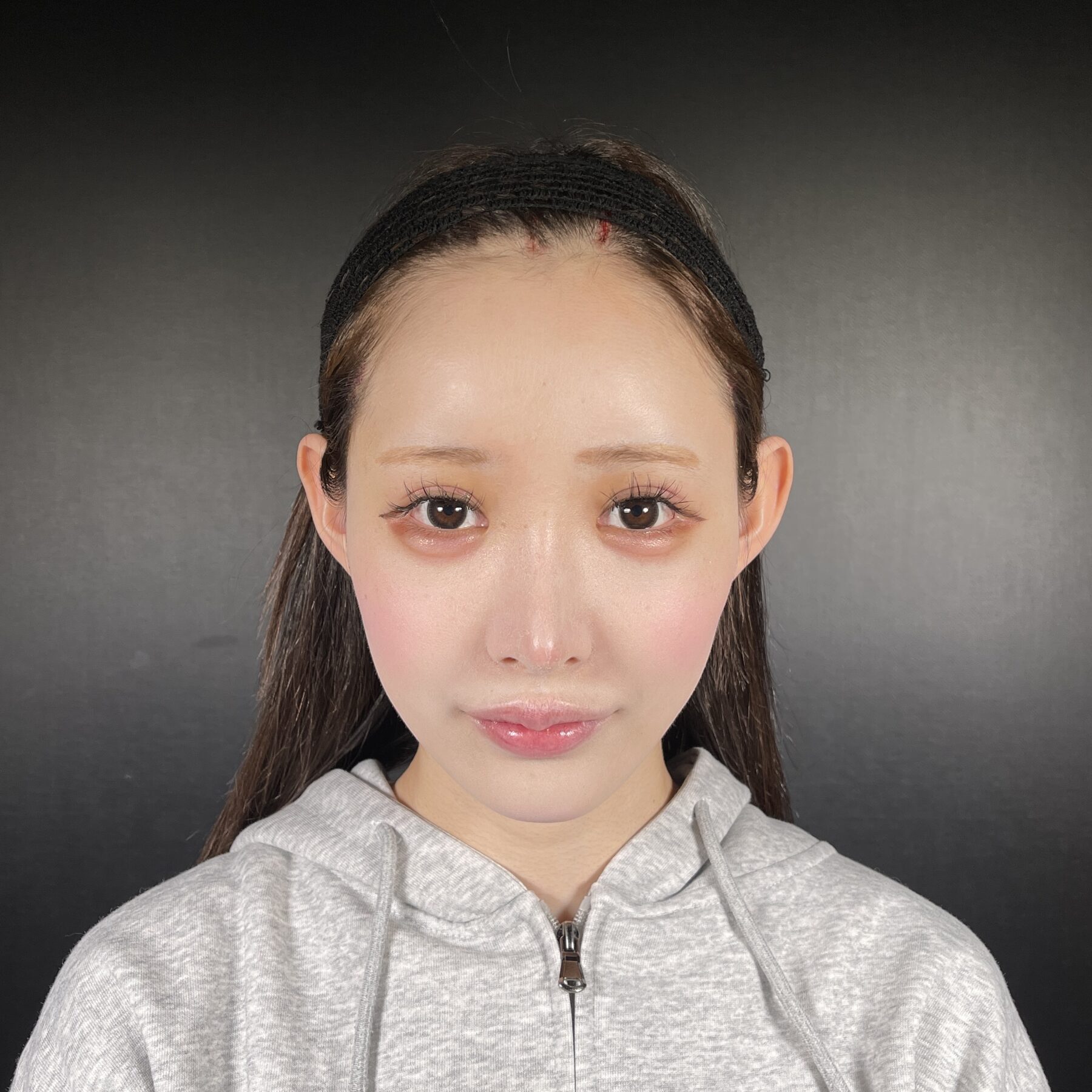 術前