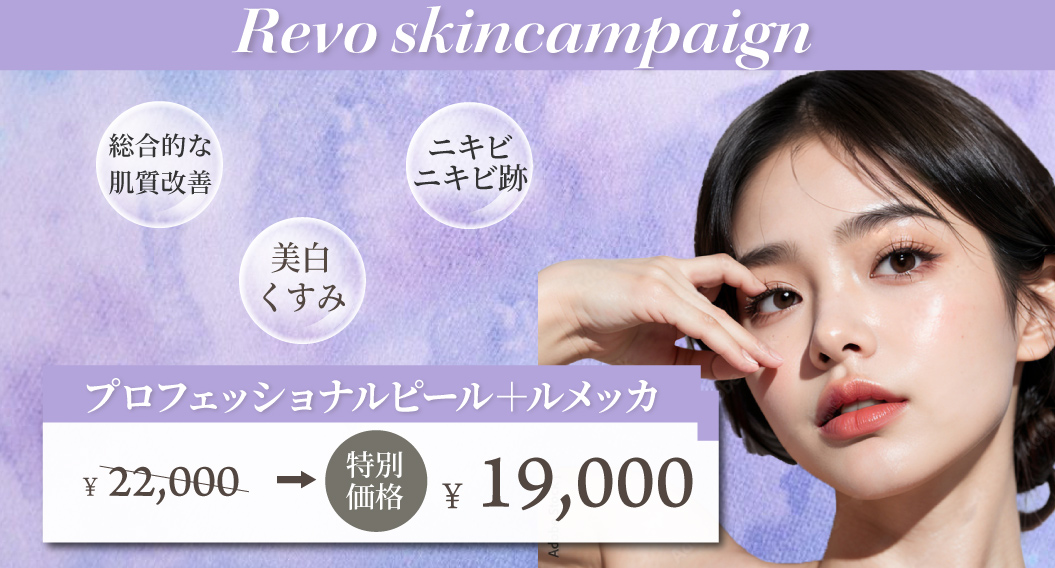 Revo