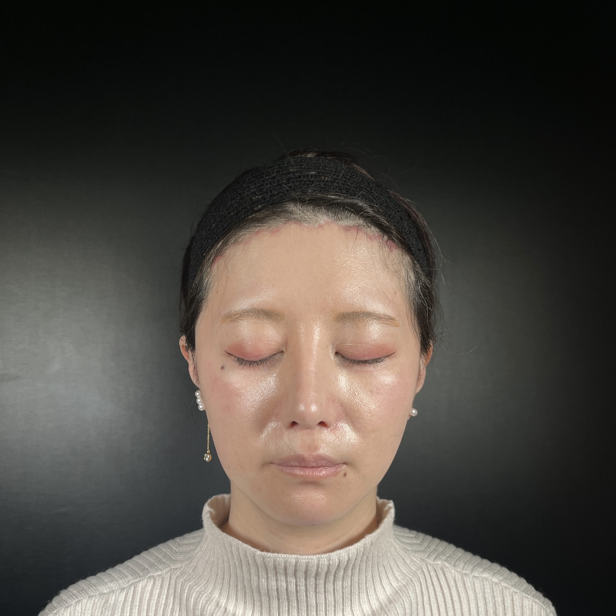 術前