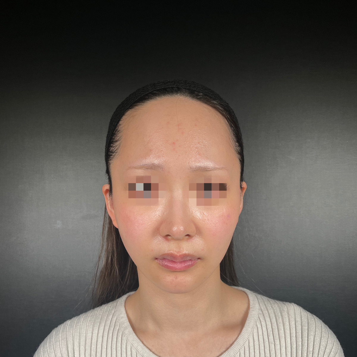 術前