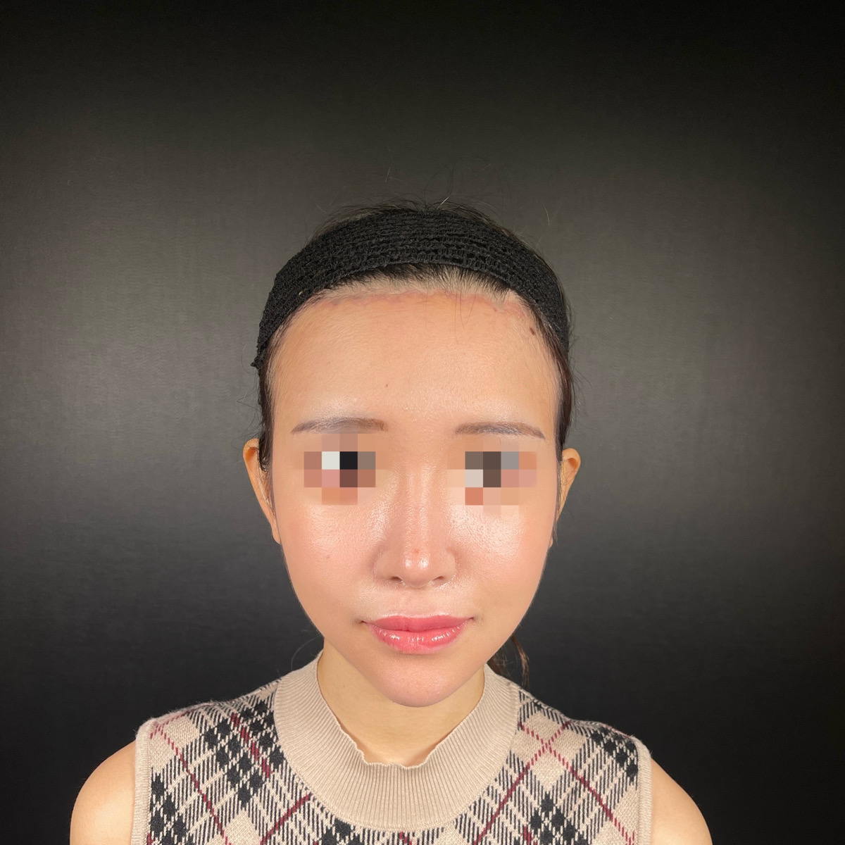 術前