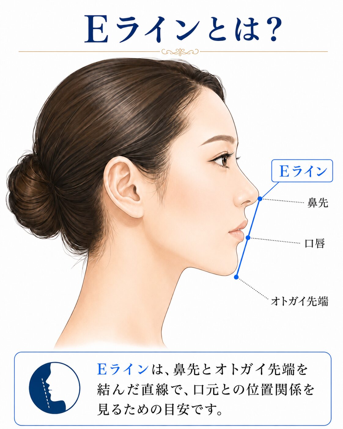 Eラインを整える顎プロテーゼとは？オトガイ後退と口元の突出感を改善する方法