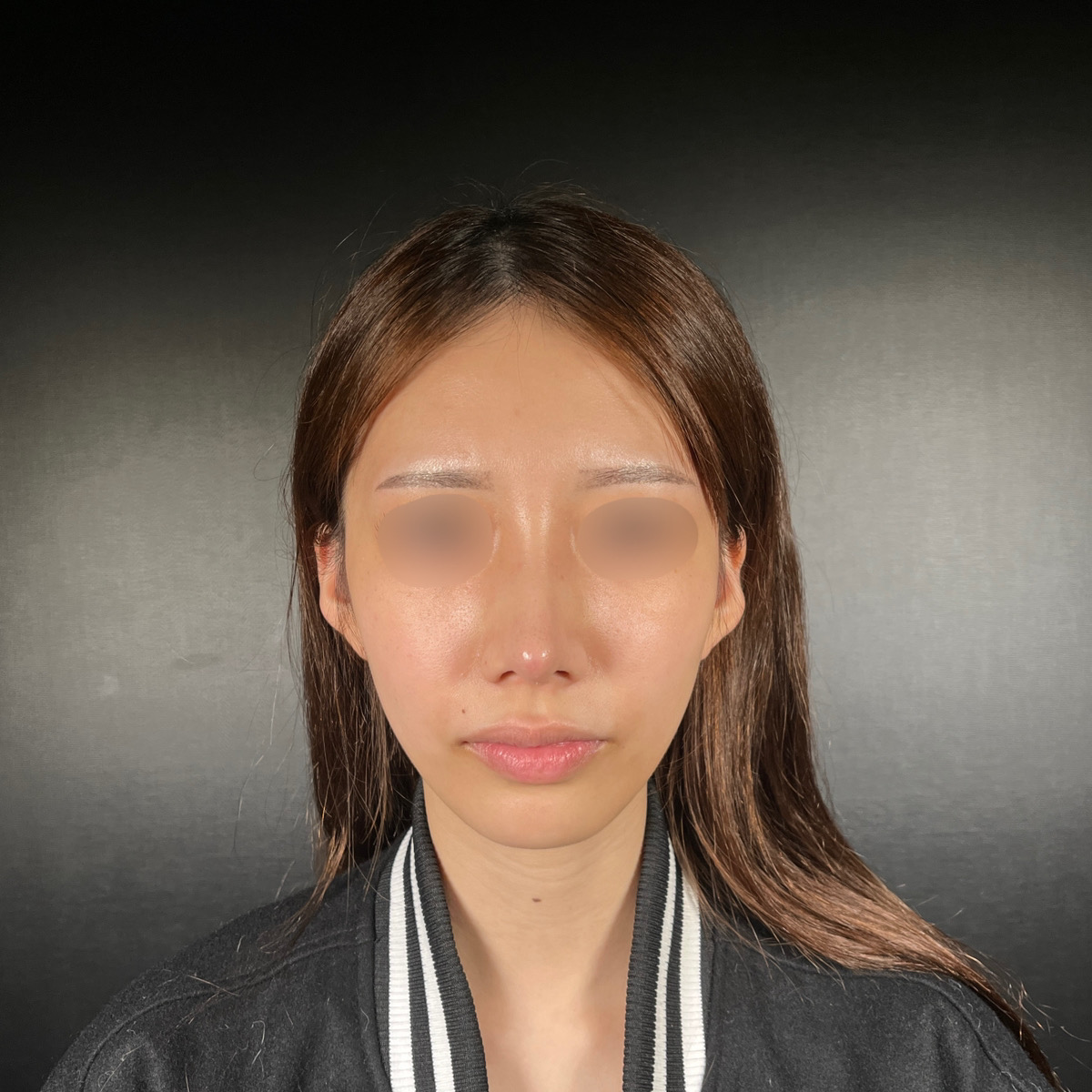 術前