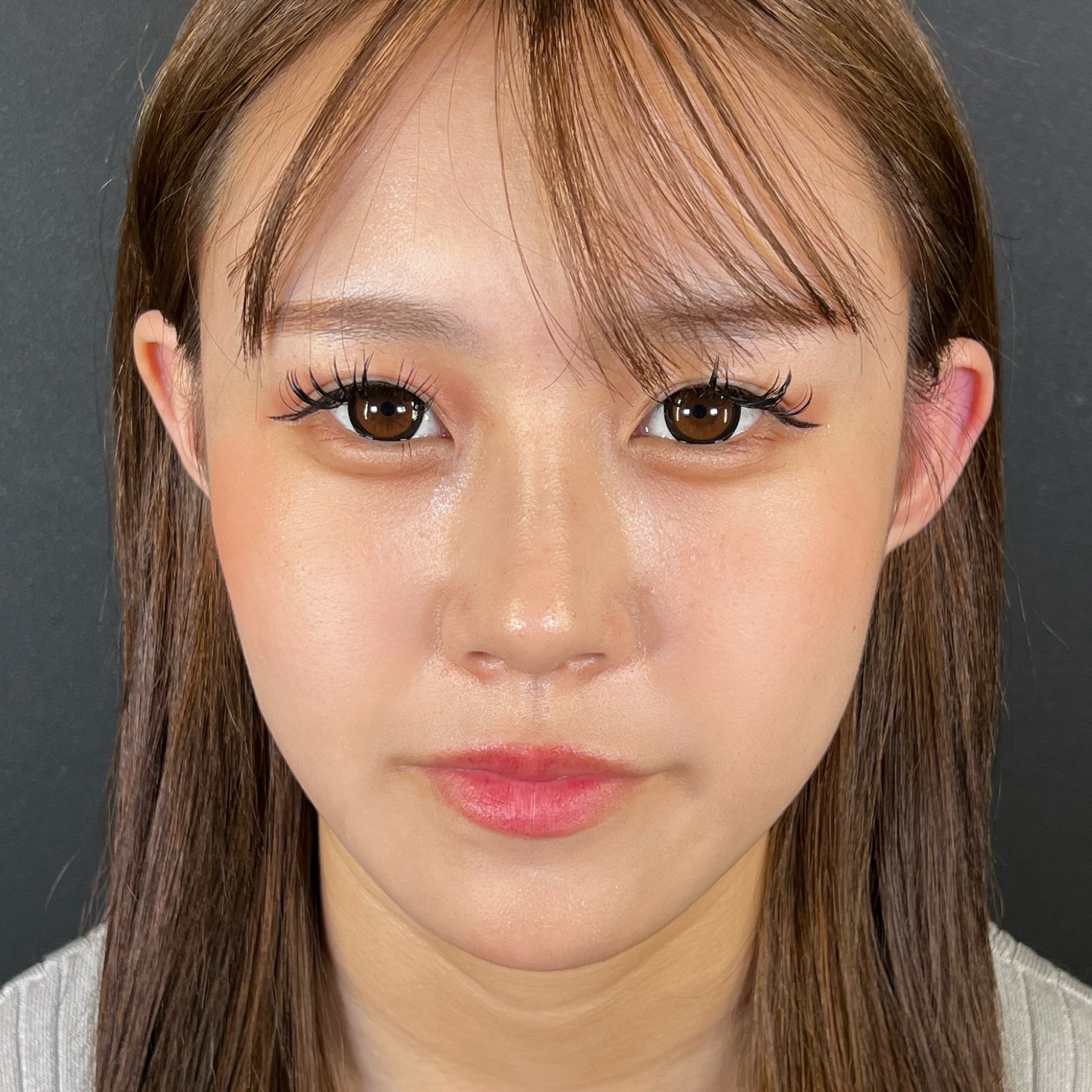 術後