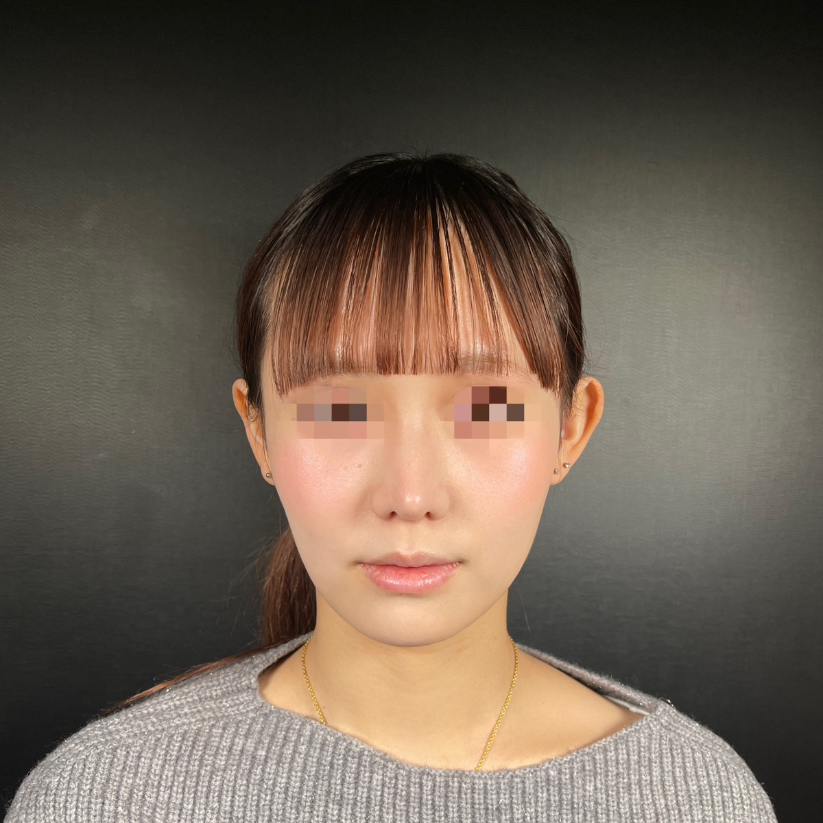 術前