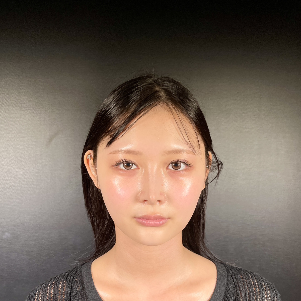 術前
