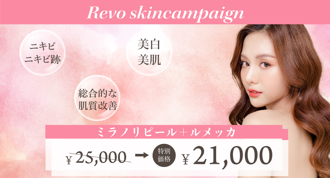 Revo