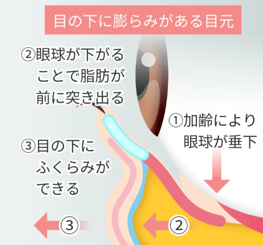 クマ治療の手術中の痛み！！実際どうなの？