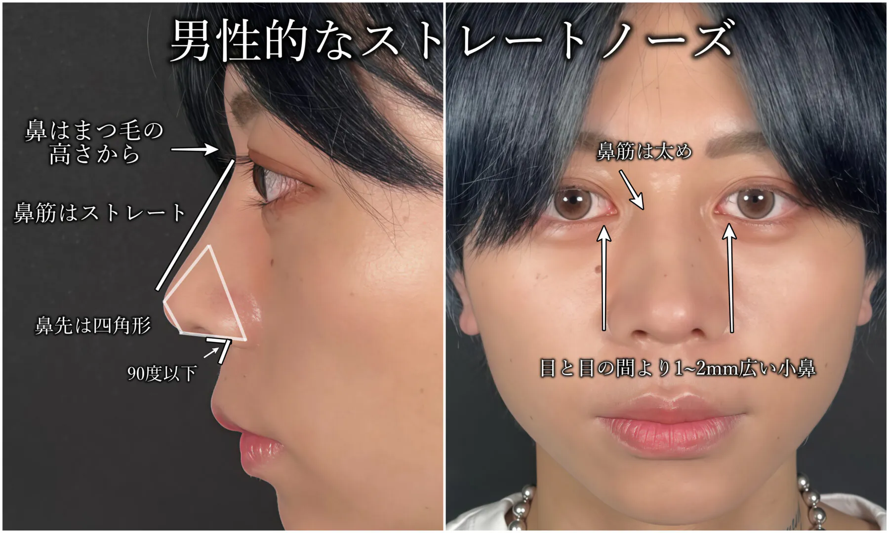 自分の顔にあった鼻のデザインとは?顔の特徴による似合う鼻を解説 | アールビューティークリニック 銀座・名古屋・大阪|美容整形・美容外科・美容皮膚科