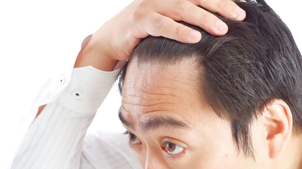 おでこのシワをなくす男性向けの方法10選!額のシワの原因や改善法、ヒアルロン酸などのメンズ整形を解説