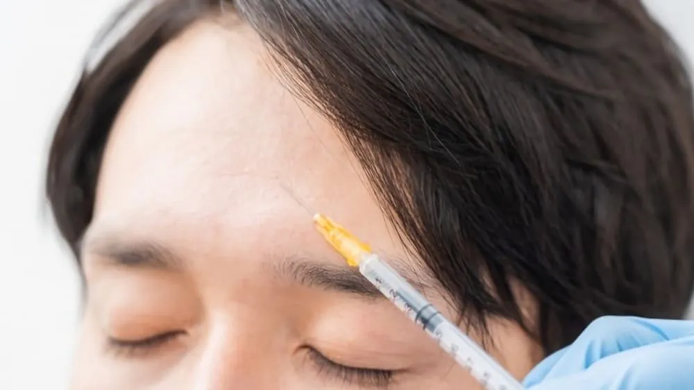 男性がおでこのシワをなくすおすすめの5つの美容整形