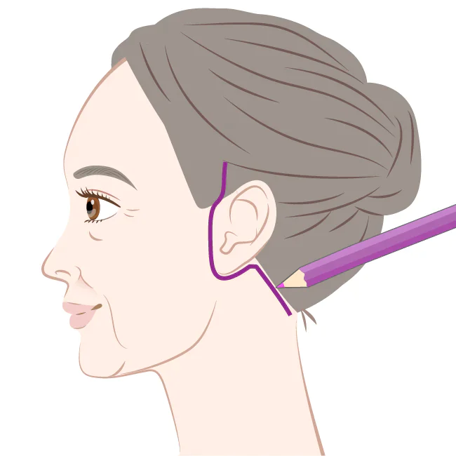 フェイスリフト・ネックリフト | アールビューティークリニック 銀座