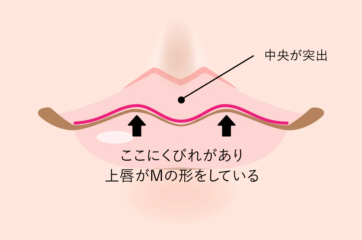 M字リップとは