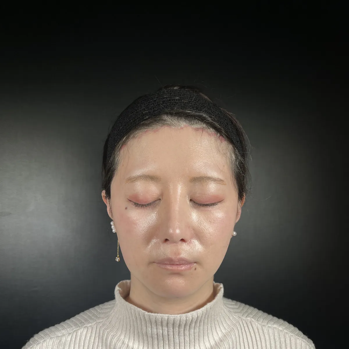 術前