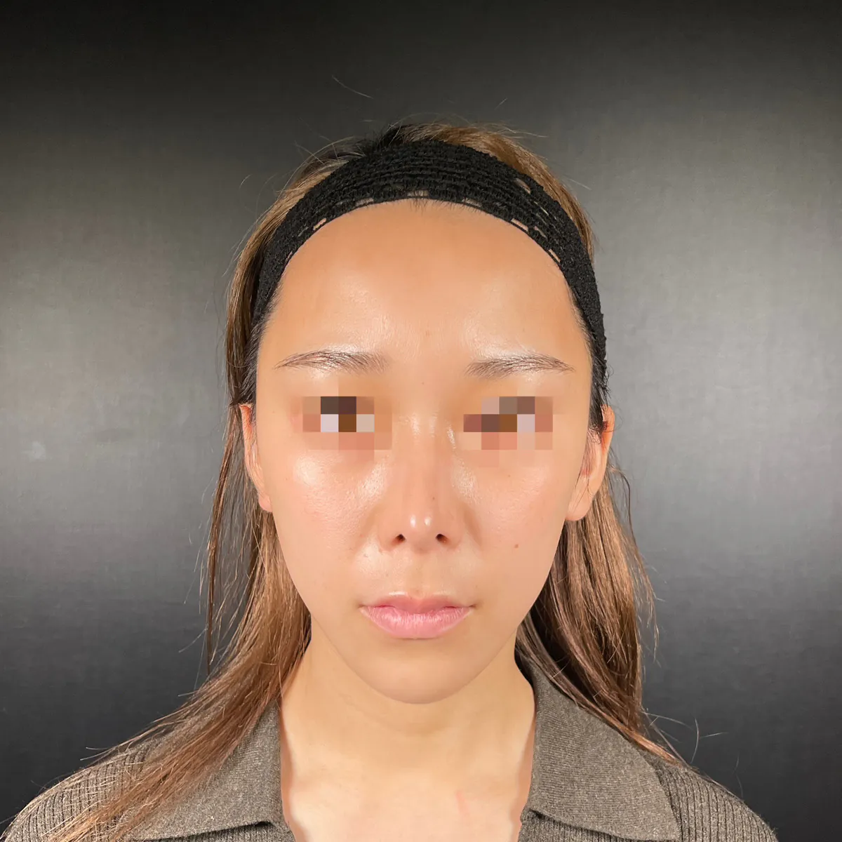 術前