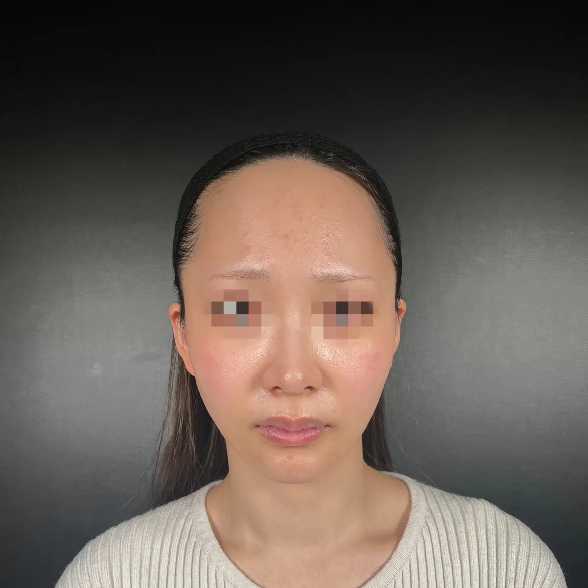 術前