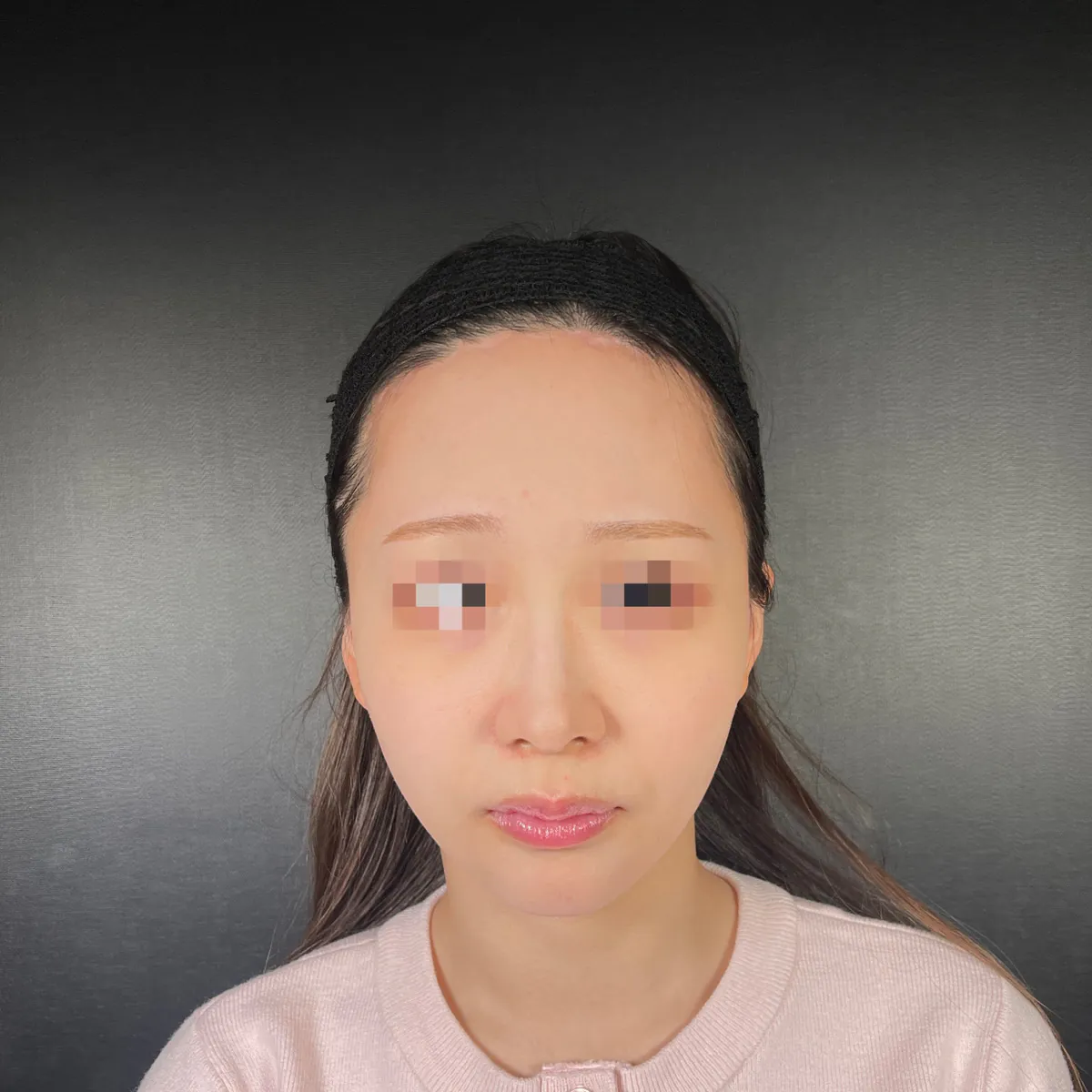 術前