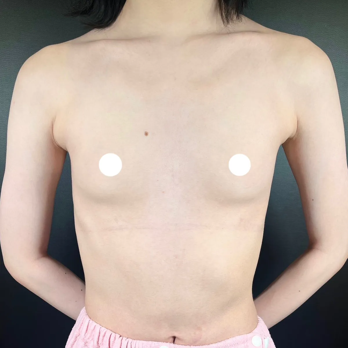 術前