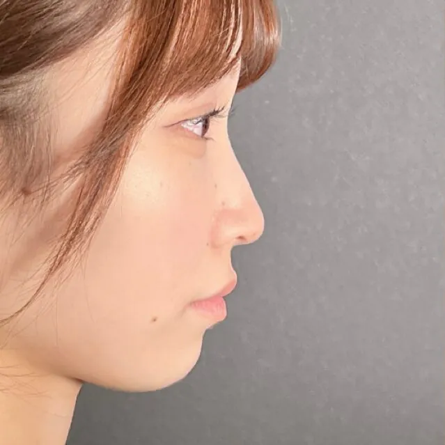 術前