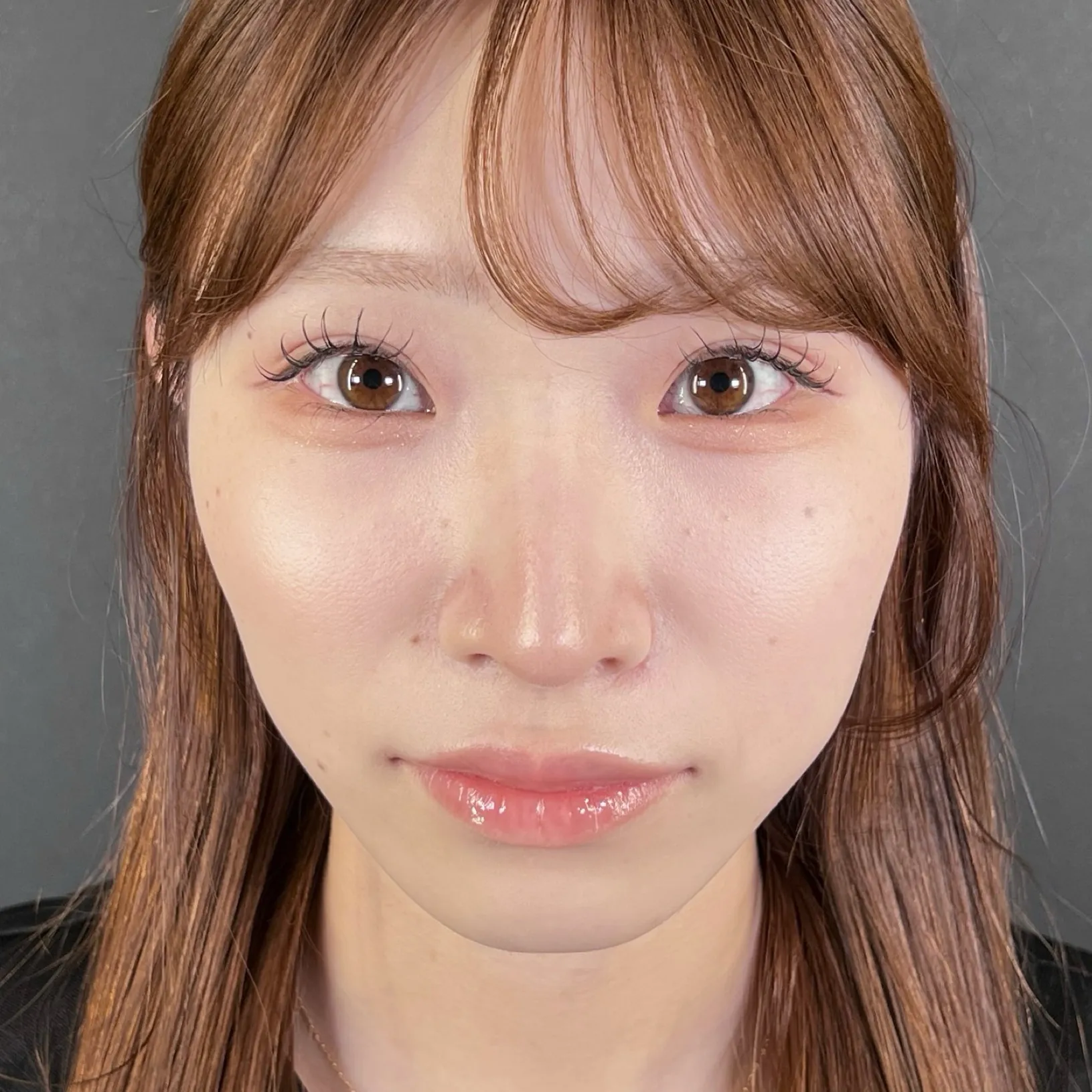 術後